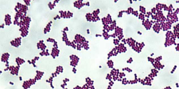 Staphylococcus aureus, gram positive spherical bacteria, 500X at 35mm. Spherical cells (cocci) arranged in grapelike clusters. M