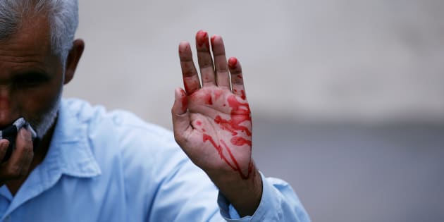 Azadi Resurrected: A Referendum In Blood