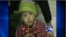 Chopstick lodges in child's nose
