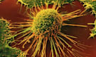 Cancer cell