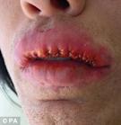 Pete Burns