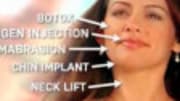  Let's recap the premise of E!'s new reality T.V. show, Bridalplasty. If you haven't seen it, it's a show where brides-to-be compete for extreme plastic surgery procedure...
