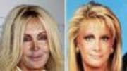  If actress Joan Van Ark of Knots Landing fame could turn back time - it's safe to say the actress might think twice before ruining her once stunning looks with cosmetic ...