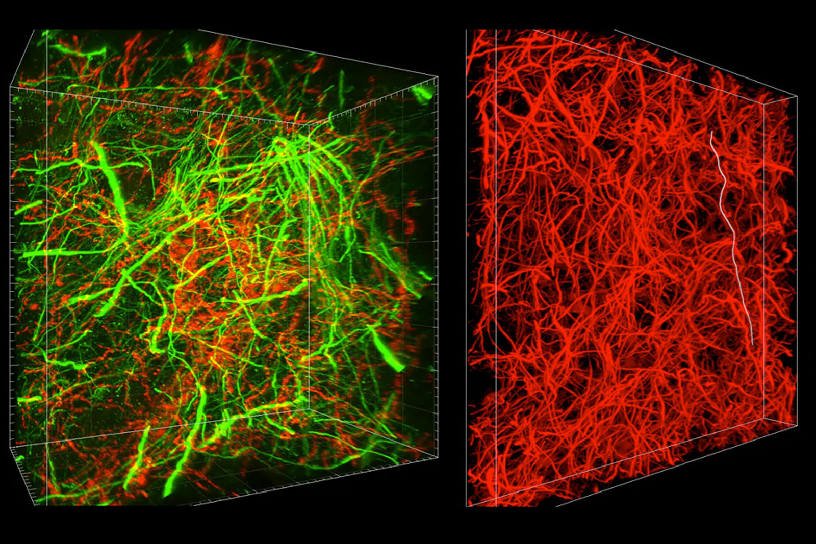 photo of 3D imaging helps map tiny connections in the brain image
