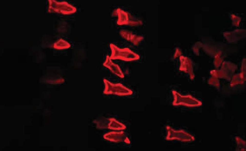 photo of Microscopic 'fish' could clean toxins from your bloodstream image