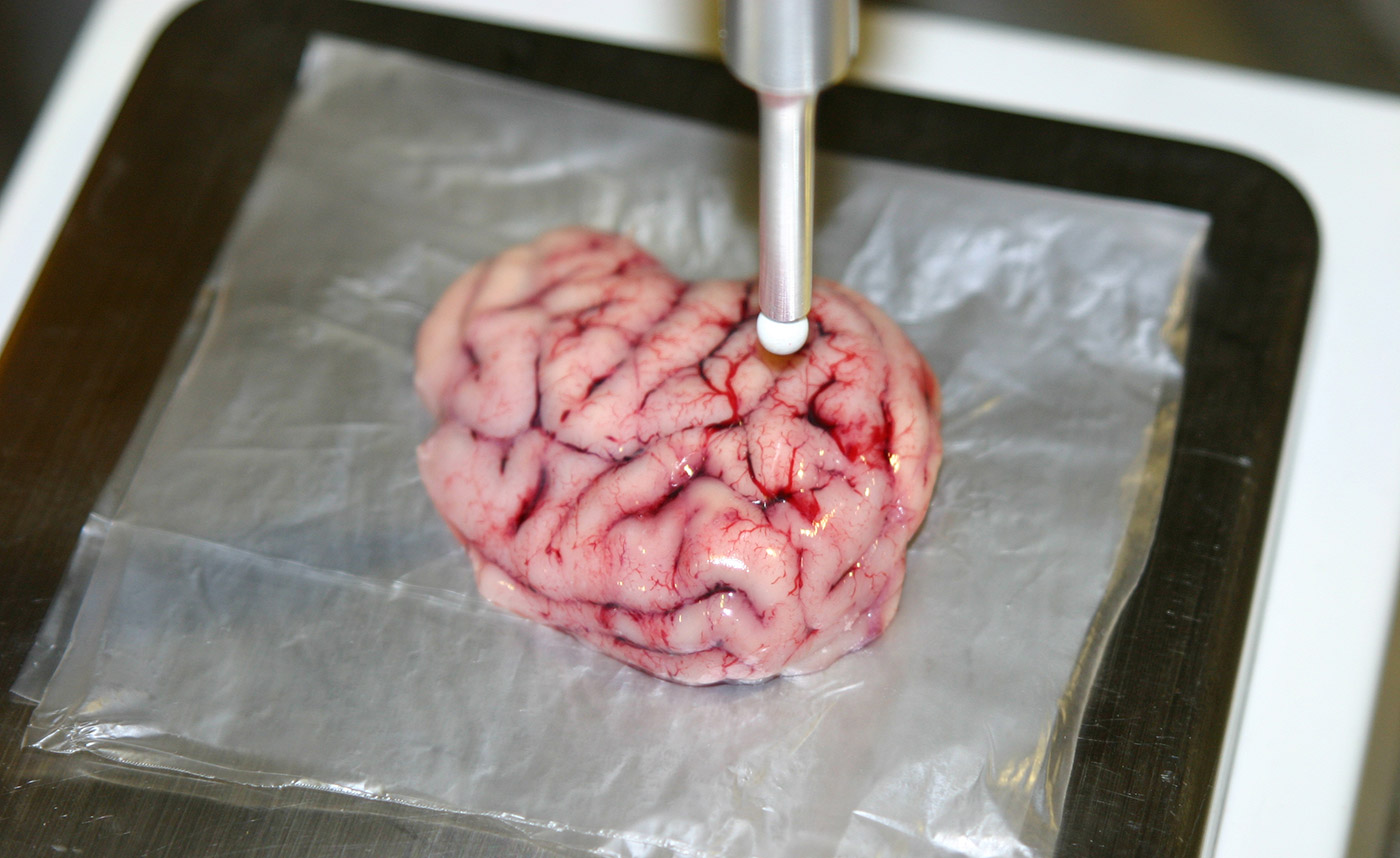 High-tech scalpel makes brain surgery less risky