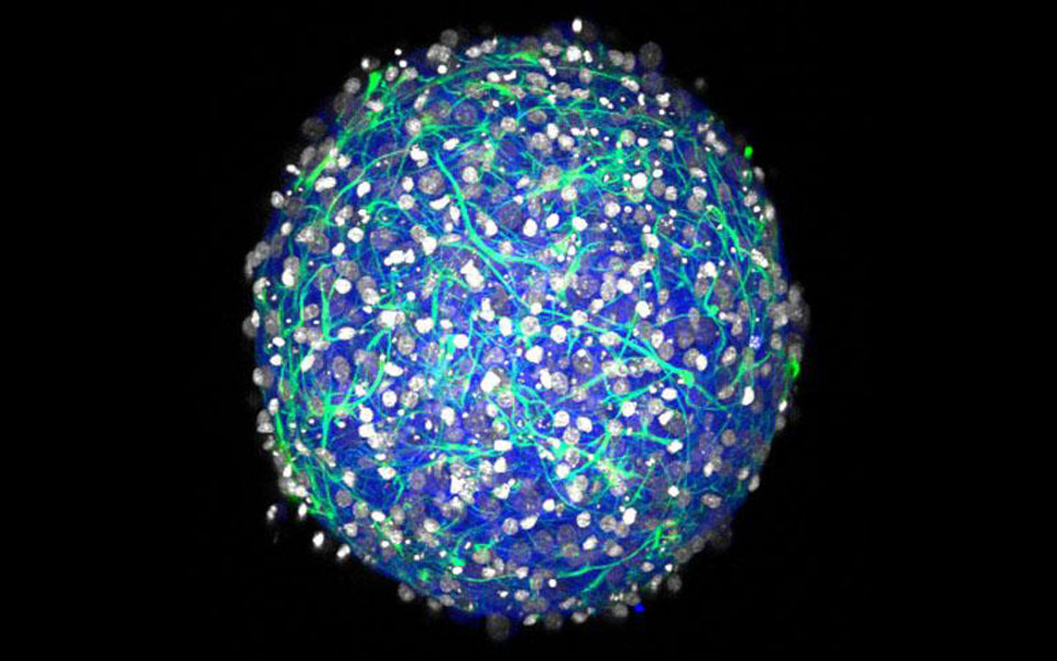photo of Easy-to-make mini brains will help medical research image