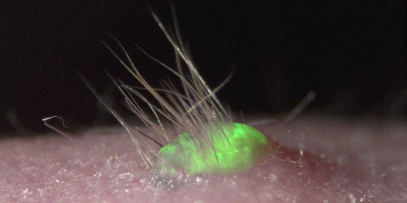 Artificial skin grows hair and sweat glands