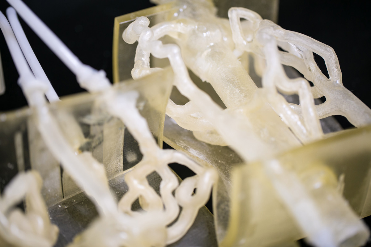3D-printed vascular systems help doctors practice for your surgery