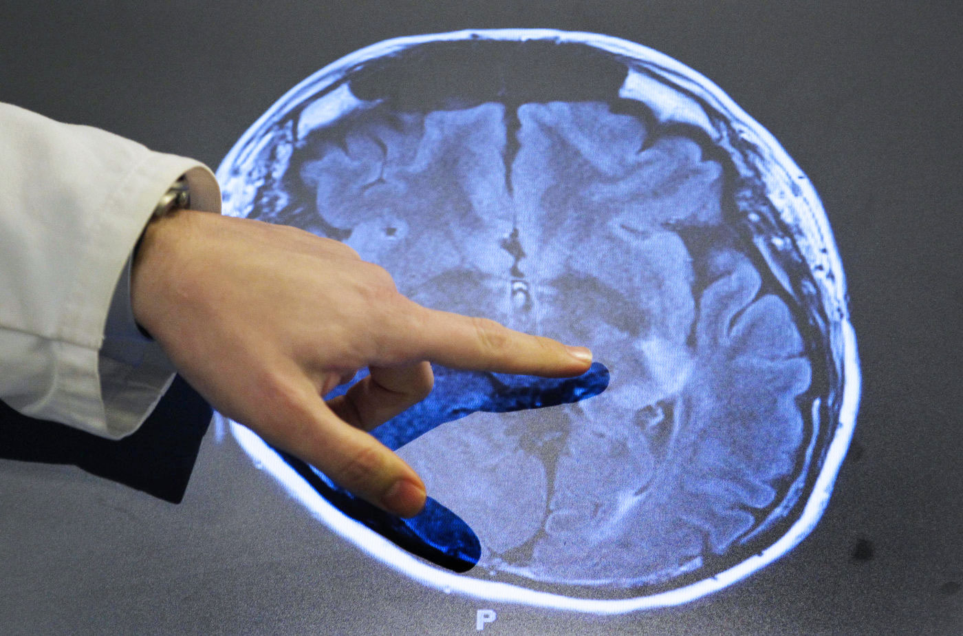 Biotech companies get permission to test brain death reversal