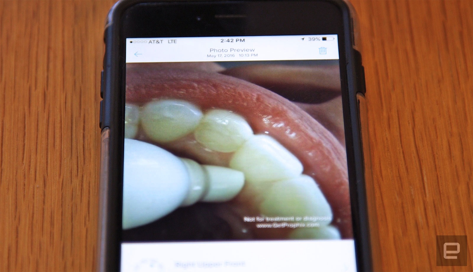 The Prophix smart toothbrush will film the inside of your mouth