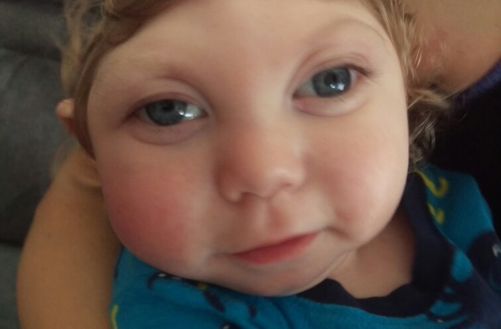 Parents of 'miracle baby' with microcephaly speak out amid ...