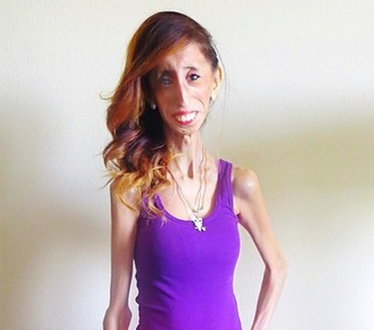 Lizzie Velasquez Beat Her Online Bullies in the Most Amazing Way ...