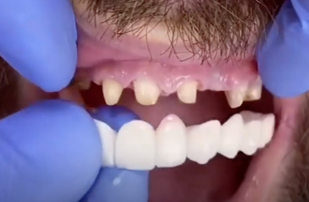 Watch this dentist fix a patient’s smile in minutes