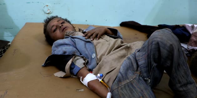 Un niño yemení, recibiendo asistencia tras el ataque de hoy. 