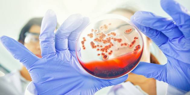 Eliminato il virus dell’Hiv da un paziente. La notizia sulla rivista Nature: "È il secondo caso al mondo"