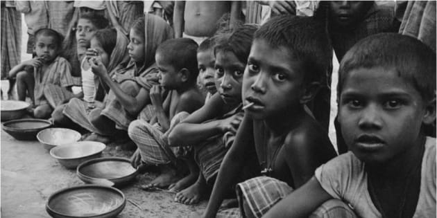 Image result for Malnutrition in india