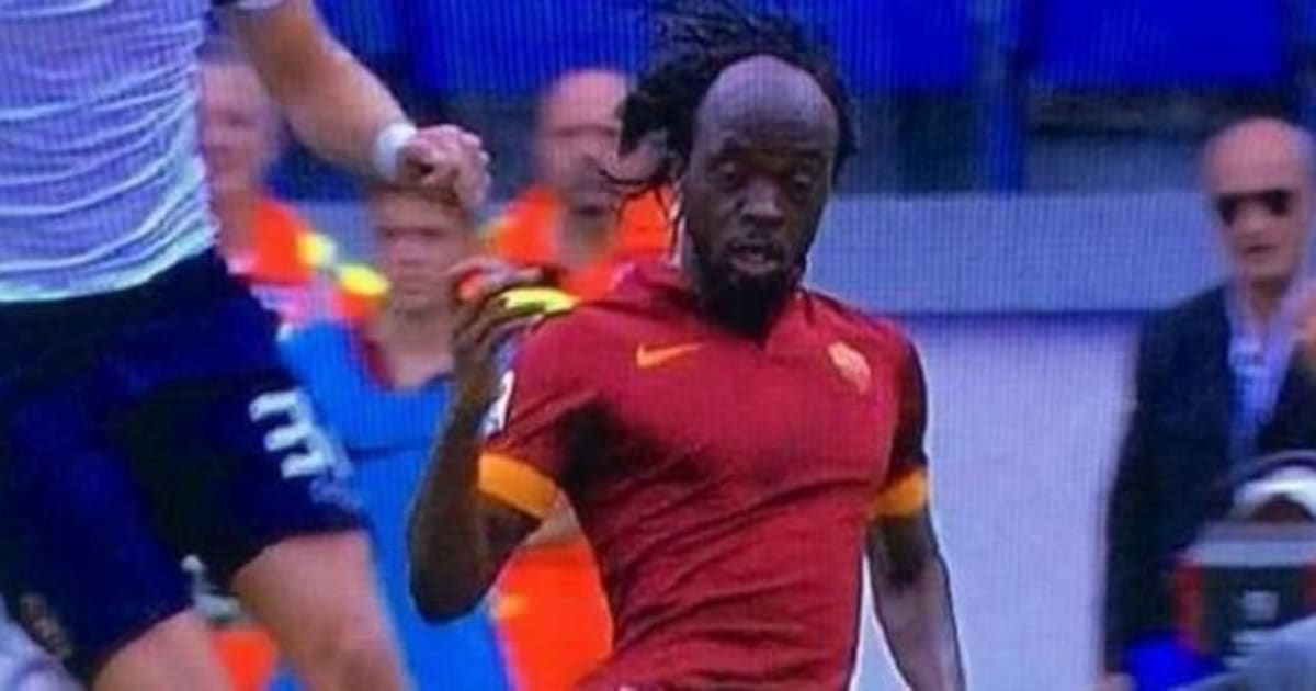 Gervinho e la calvizie in diretta tv. Perde la fascia ...