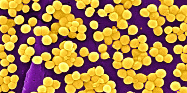 Drug-Resistant Golden Staph Breakthrough Tested By Volunteer Australian ...