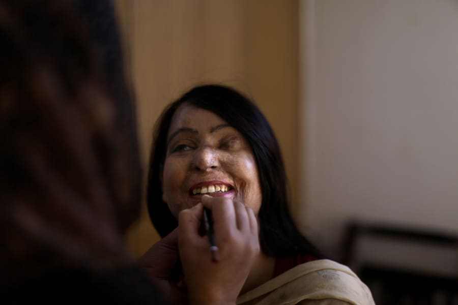 Naila Farhat, sobreviviente de un ataque de Ã¡cido a los 22 aÃ±os, es maquillada para salir a la