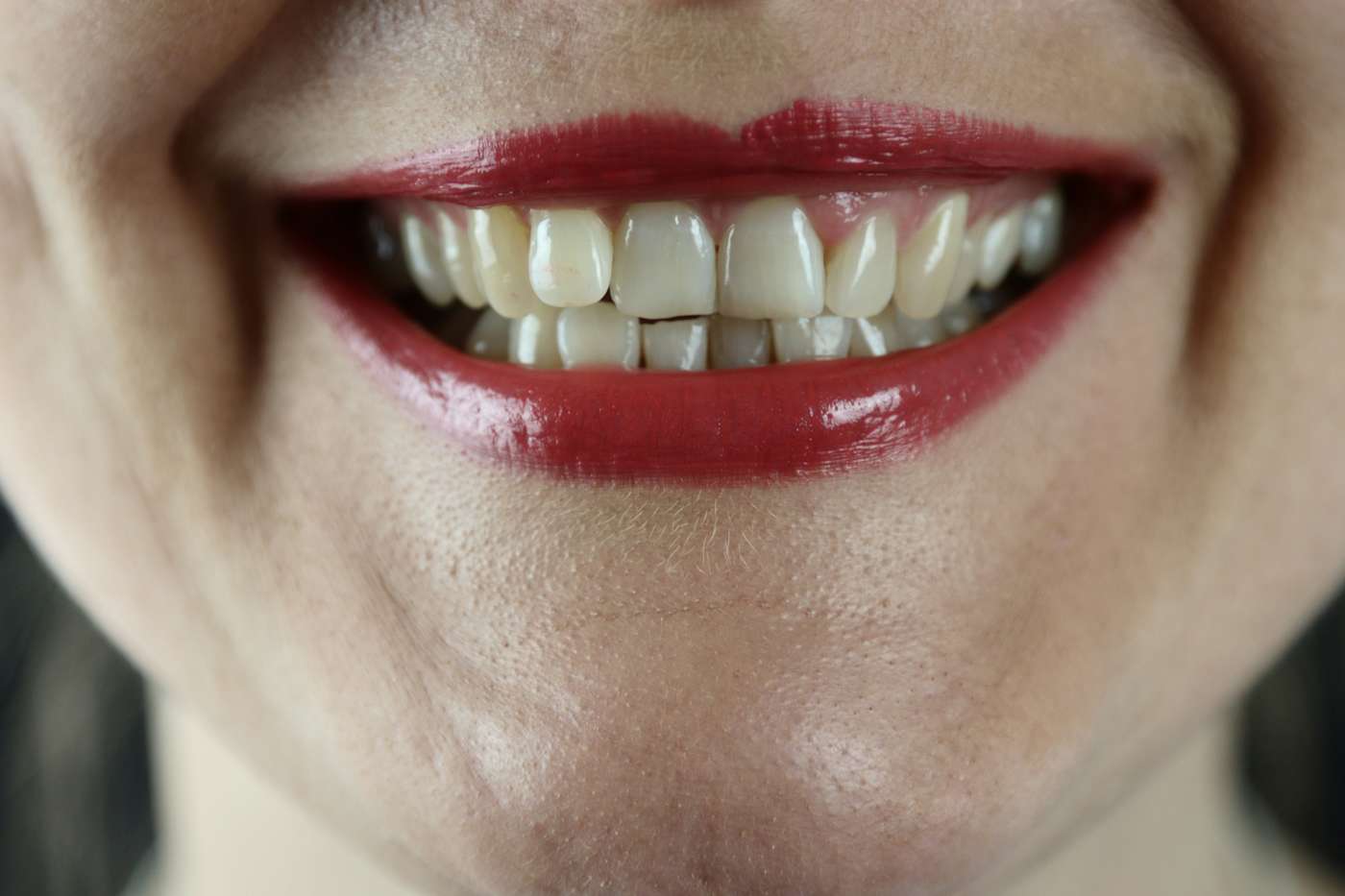 The world's first tooth-regrowing drug has been approved for human trials