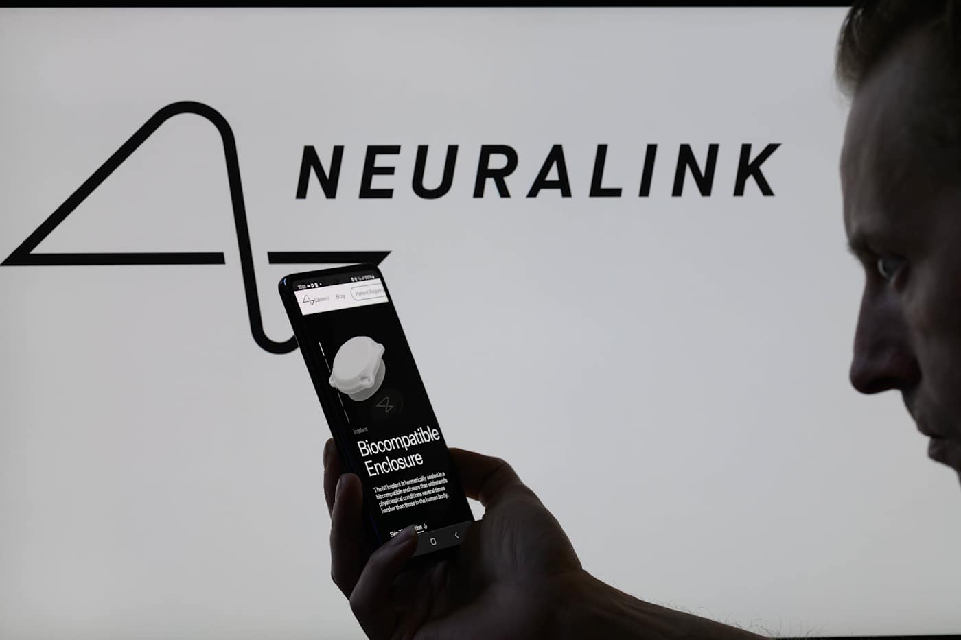 Neuralink says it may have fixed its brain implant problem