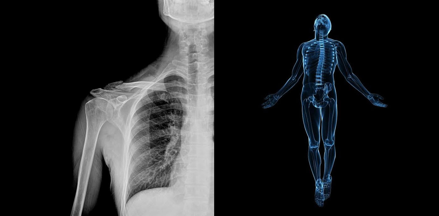 AI 'doctors' will diagnose your X-rays | Engadget