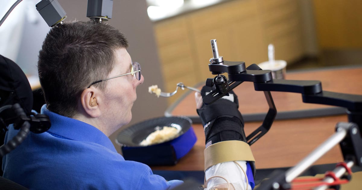 Paralyzed man first to move his arm by thinking about it